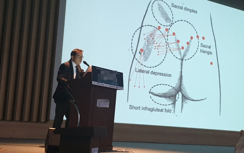 사진=허쉬성형외과 정영춘 원장