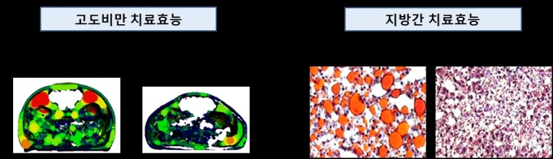 셀리버리, 미국당뇨병학회 고도비만 및 당뇨병 치료신약 발표 선정
