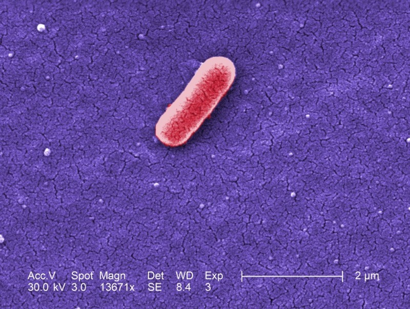 여름철 불청객 ‘세균성 설사’, 원인과 예방법은?