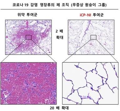셀리버리, “모든 코로나19 확진자들에게 면역치료제 반드시 투여해야”