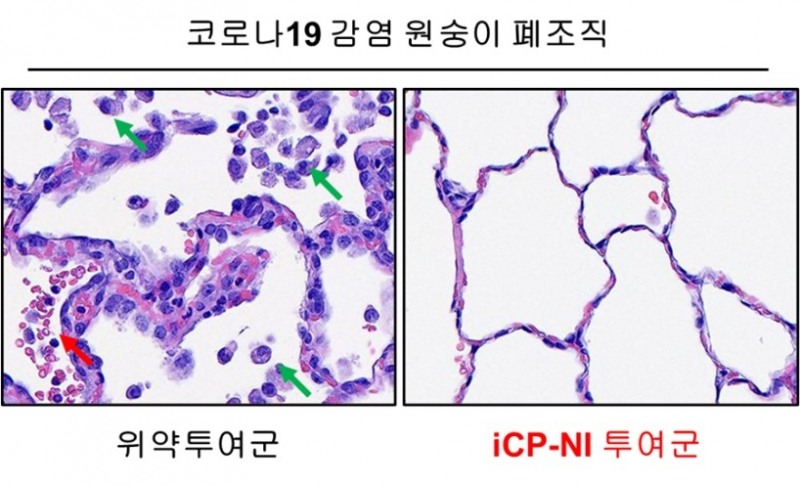 셀리버리, 코로나19 치료제 영장류시험 분석종료 및 최종보고서 수령…코로나19 완치