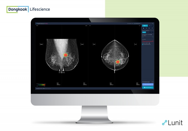 동국생명과학, AI로 암 진단하는 루닛으로 국내시장 공략