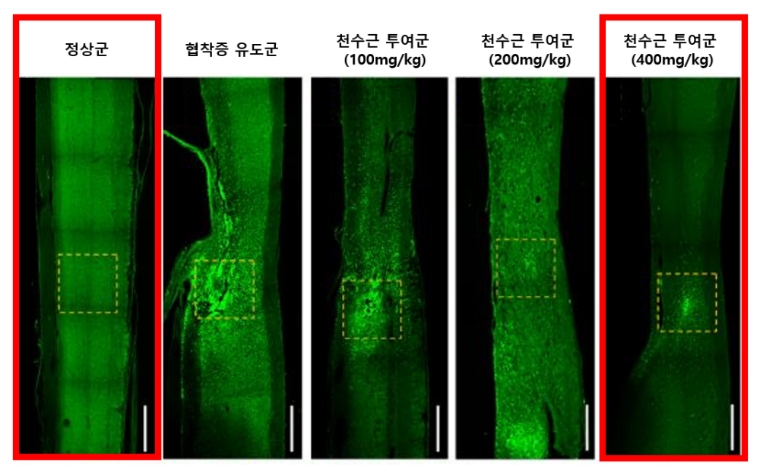 실리콘 이식 부위에 집중됐던 염증성 대식세포가 천수근에 농도 의존적으로 감소했다. 사진=자생한방병원