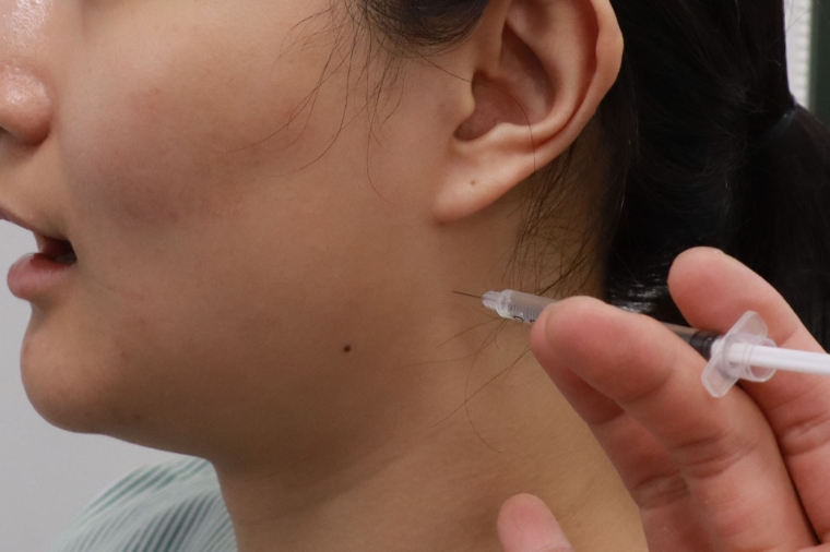 자생한방병원 “만성 턱관절 장애, 물리치료보다 약침이 더 효과적”