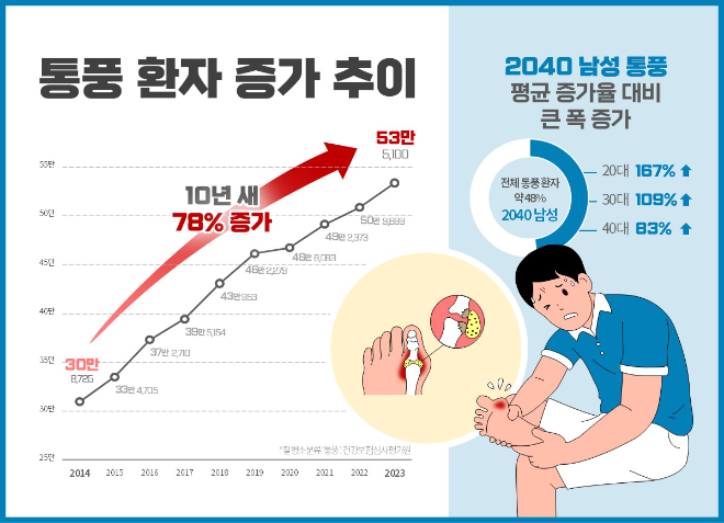 통풍 환자, 10년새 73% ↑..."20대 남성 식습관 변화 주의해야"