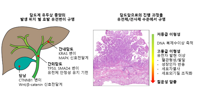 담도계 전암 병변으로부터 담도암의 발생 과정에서 나타나는 유전자 변이와 유전자 발현 이상 양상. 사진=한국연구재단