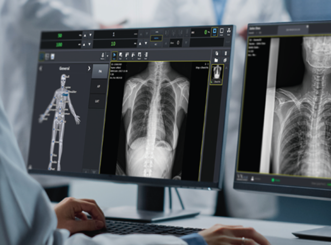 뷰웍스 디지털 의료영상 획득 및 처리 소프트웨어, '브이엑스뷰'(VXvue).(사진=뷰웍스)