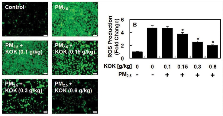 미세먼지에 의한 활성산소(ROS) 증가 및 경옥고의 항산화 평가 결과. 정상 폐조직(좌측 상단)은 검은 색으로 보이며, 미세먼지 노출 시(우측 상단) 초록색으로 활성산소가 증가한다. 경옥고 투여군(우측 하단)에서 활성산소 발생이 감소한 모습을 확인할 수 있다. (사진=광동제약 제공)