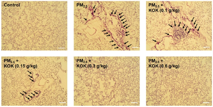 미세먼지에 의한 폐 손상 및 경옥고의 보호 효과. 정상 폐조직(좌측 상단)의 모습에 비해 미세먼지에 노출된 경우(중앙 상단) 손상된 모습을 볼 수 있다. 이에 비해 경옥고 투여군(우측 하단)의 경우 조직 손상 정도가 감소한 모습을 확인할 수 있다. (사진=광동제약 제공)