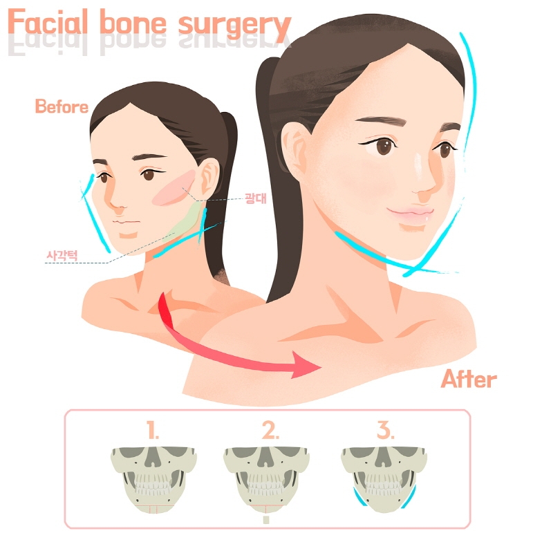 사진=아이디병원 제공
