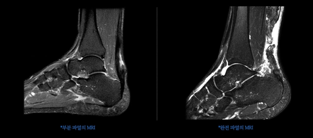 '뭉쳐야 찬다'로 부는 조기축구 열풍, 이것만은 조심해야