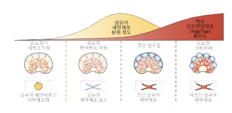 림프절 내 섬유아 세망세포의 분화 정도와 히포 신호전달경로 연관성. 사진=IBS