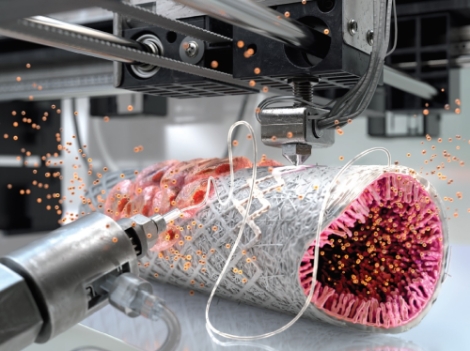 서울대병원 이비인후과 권성근 교수팀은 기관 재협착을 방지할 수 있는 인공기관을 개발해 전임상실험에 성공했다. 사진=서울대병원