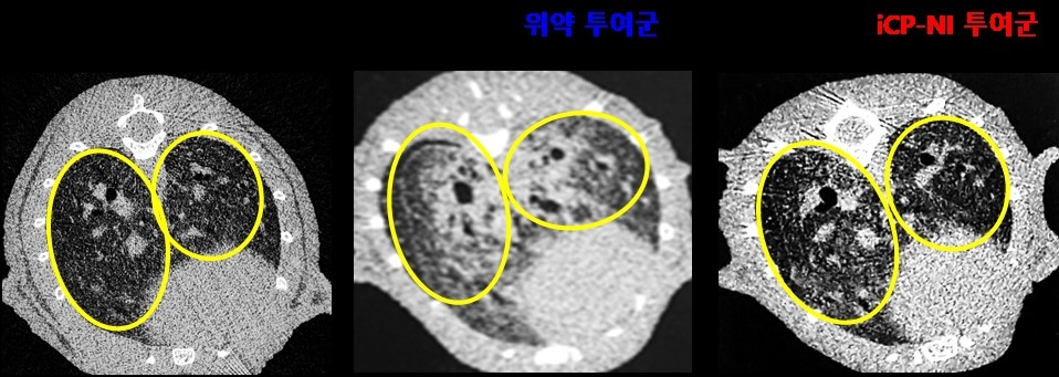 셀리버리, 싸이토카인폭풍 억제신약 iCP-NI 폐 섬유화 치료효능 확보