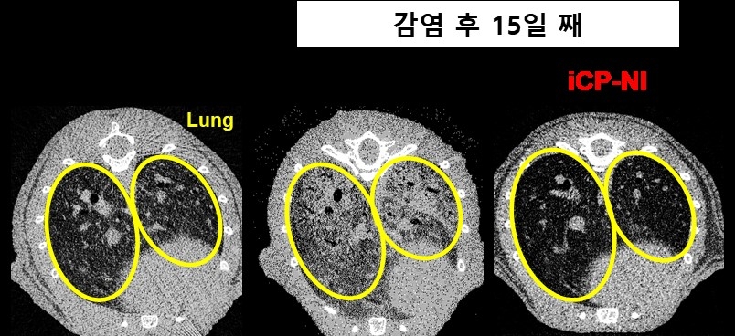 셀리버리, 코로나19 치료제 개발상황 바이오코리아 특별세션 발표