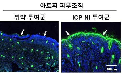 셀리버리, 면역염증치료제 iCP-NI 아토피 자가면역질환 치료제 임상개발 본격화