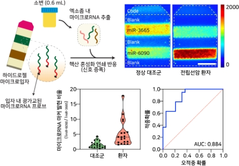채혈 없이 소변으로 전립선암 진단한다