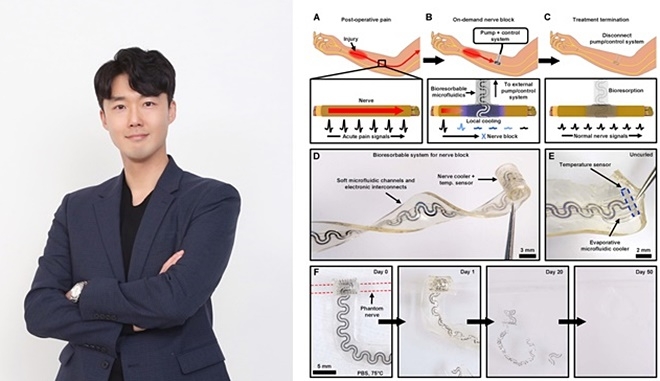 부산대 서민호 교수/신경신호 전달 조절을 위한 부드럽고 생체 내 분해되는 생분해성 미세유체냉각 소자. a-c. 개발된 기술을 이용한 통증 완화 모식도. 인체의 통증은 신경을 통해서 뇌로 전달되는데(a) 개발된 기술은 생체에 삽입돼 국소적으로 말초신경을 냉각함으로써 통증 신호가 뇌로 전달되는 것을 막는다(b). 특히, 개발된 기술은 몸에 녹아 흡수되는 소재로 만들어졌기 때문에 통증 치료 후 체내에서 소자를 제거하는 2차 수술이 필요 없다. d. 개발된 생분해성 소자의 사진. e. 온도 센서와 미세유체채널이 집적되어 있는 신경 접속 부분 확대 사진. f. 50일 만에 생리식염수에서 사라지는 생분해성 미세유체냉각 소자 사진.(제공=부산대)