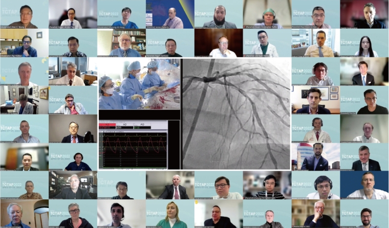 서울아산병원, 관상동맥 중재시술 국제학술대회 'TCTAP 2023' 개최