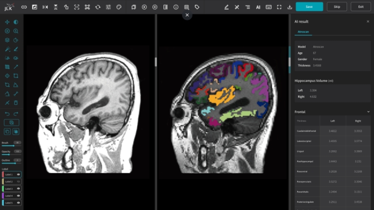 제이엘케이 ‘인공지능 기반 뇌 영역 분류 시스템’ 기술 특허 획득