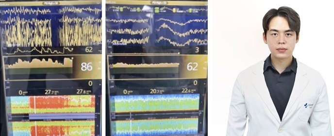 심정지 환자 뇌파 상태/최재영 중환자의학과 과장.(제공=삼육부산병원)