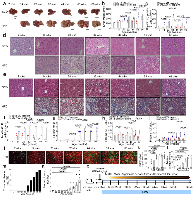 새로운 대사이상 지방간 질환 마우스 모델의 진행 양상. 사진=KAIST