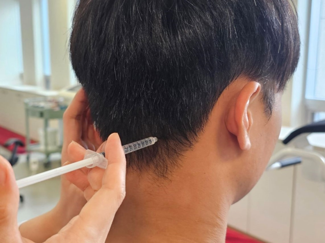 자생한방병원 “차사고로 생긴 두통에 한방 약침 효과적”