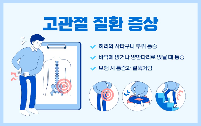 젊은 층도 안심할 수 없는 고관절 질환..."술·외상 주의해야"