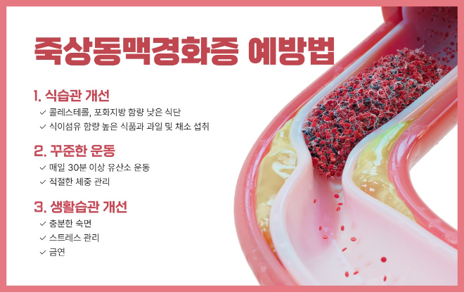 추워진 날씨...전조 증상 못 느끼는 '죽상동맥경화증' 주의해야