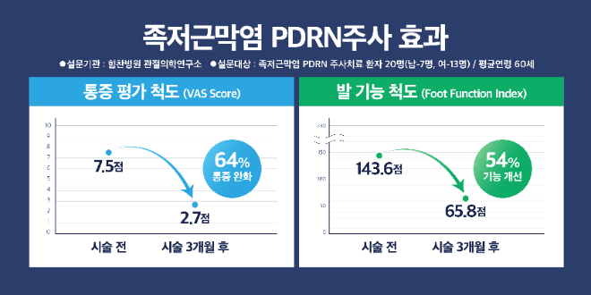 발바닥 찌릿한 족저근막염...PDRN 치료 기능개선 효과 확인
