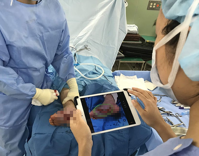 음압 창상 치료 적용 전, 연조직 결손을 적외선 3D 카메라로 촬영하는 모습. (제공=부민병원)