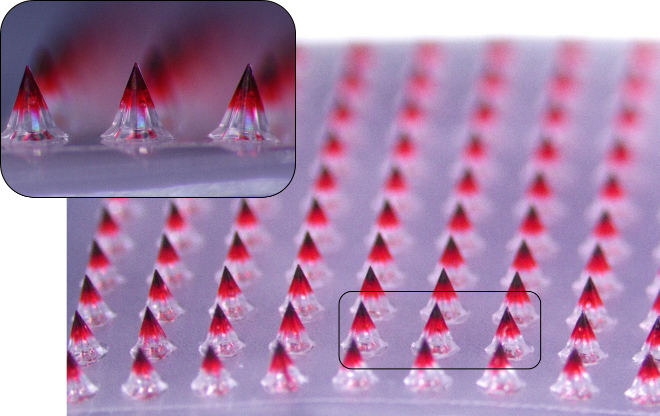 대웅, ‘마이크로니들’ 흡수율 80% 이상 결과 확보..."글로벌 최고 수준"