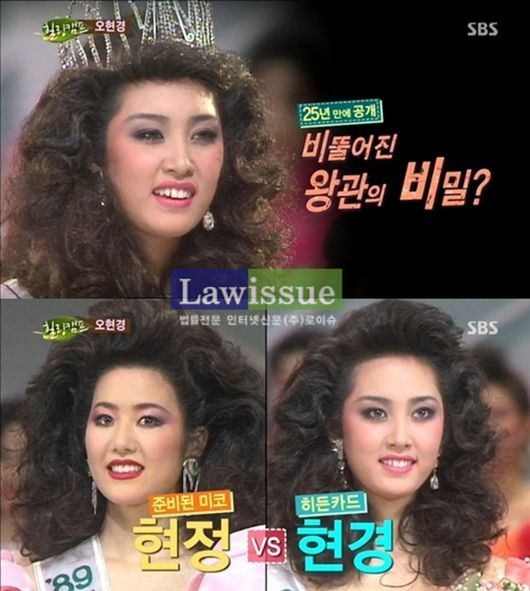 아는형님 오현경, 악관절 수술 3번..."예뻐지기 위해서 했다는 소리들을 때 억장이 무너져"