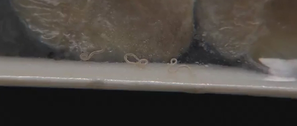 '고래회충' 밥먹다가...이 무슨 일이 '낭패'