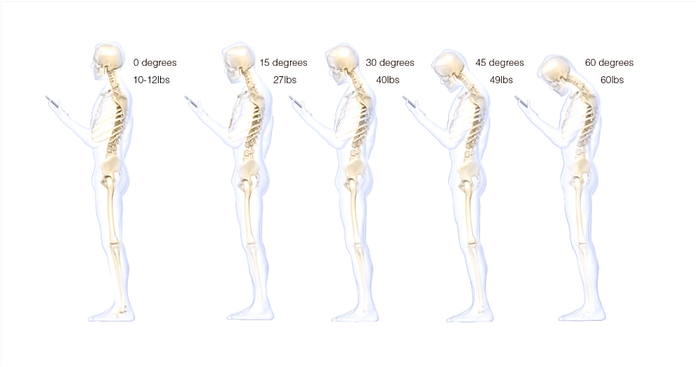 머리의 각도에 따른 하중 변화(사진=자생한방병원)