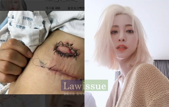 한예슬 '지방종' 그리고 차병원, 이른 아침까지 뜨거운 감자....어쩌다가 이런 일이