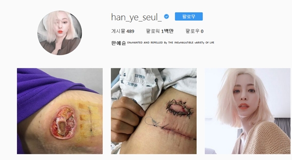 한예슬, 의료사고 둘러싸고 잡음...'기나긴 공방예상 '