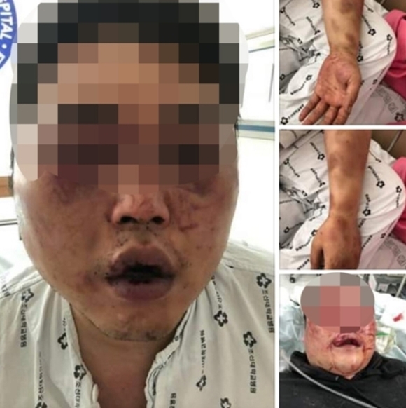 광주 폭행, 다수의 몹쓸짓에 무참히 망가져...이런 일이 어쩌다가