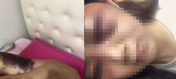 광주 데이트폭력, '둘러싸고 또 분개 움직임....얼마나 맞았는지 가늠안될 정도'