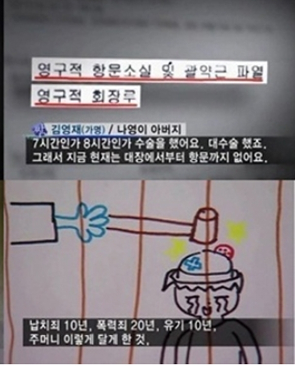 조두순, 이름석자만으로 여전히 공분...싸늘한 대중들의 시각'