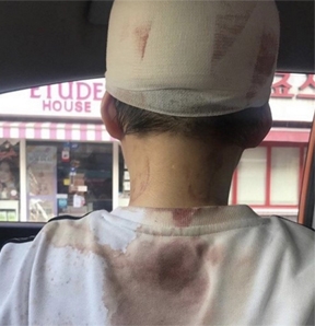 돌이킬 수 없는 행동...한 역근처에서 폭행, '부글부글 들끓는 '분개'