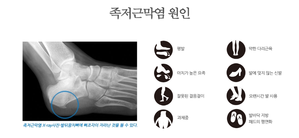 대형마트가 부상병동? 서서 일하는 노동자들에게 의자가 필요한 이유