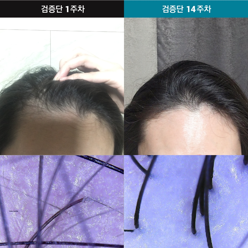 자올 닥터스오더, ‘자올 200일 리얼 검증단’ 중간고사 결과는?