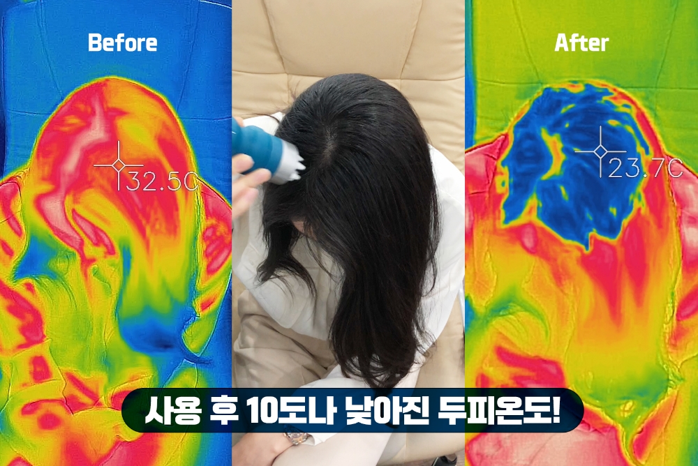 두피열 내려주는 ‘자올 부스터’ SNS 영상 화제