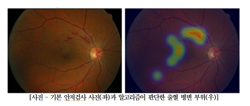 (사진=분당서울대병원)