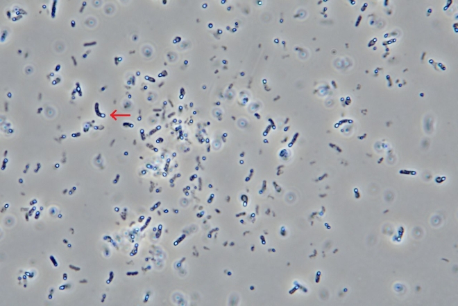 대웅제약 “나보타 균주, 포자감정시험 통해 메디톡스와 다른 균주 입증”