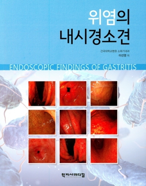 건국대병원 소화기내과 이선영 교수가 ‘위염의 내시경 소견’을 출간했다. 사진=건국대병원