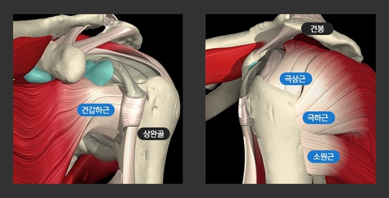 아직 젊은데 벌써 오십견이? 오십견과 착각하기 쉬운 이 질병