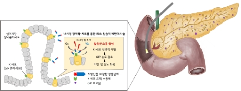 지방산-광응답제 접합제를 이용한 비만 대사성 질환 광역학 치료 개념도. 사진=한국연구재단