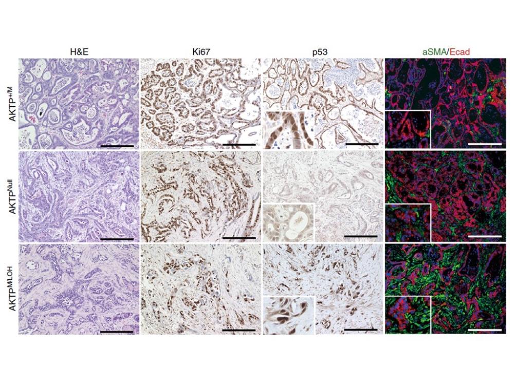 테라젠바이오, ‘항암유전자 P53’ 암 전이 및 악성화 유발 기전 규명